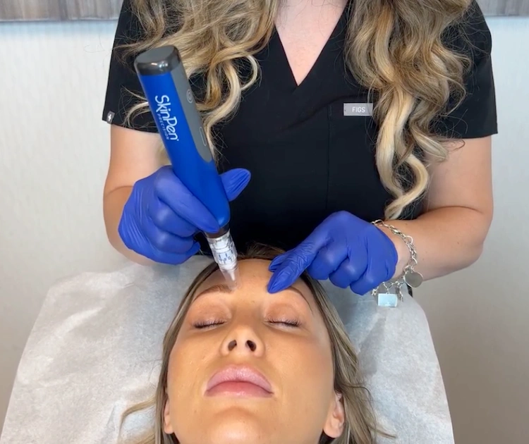 patient getting a microneedling treatment at myevergreen med spa