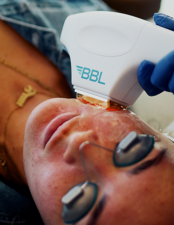 Lasers & Aesthetic Devices gallery category image