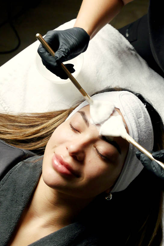 patient receiving chemical facial treatment