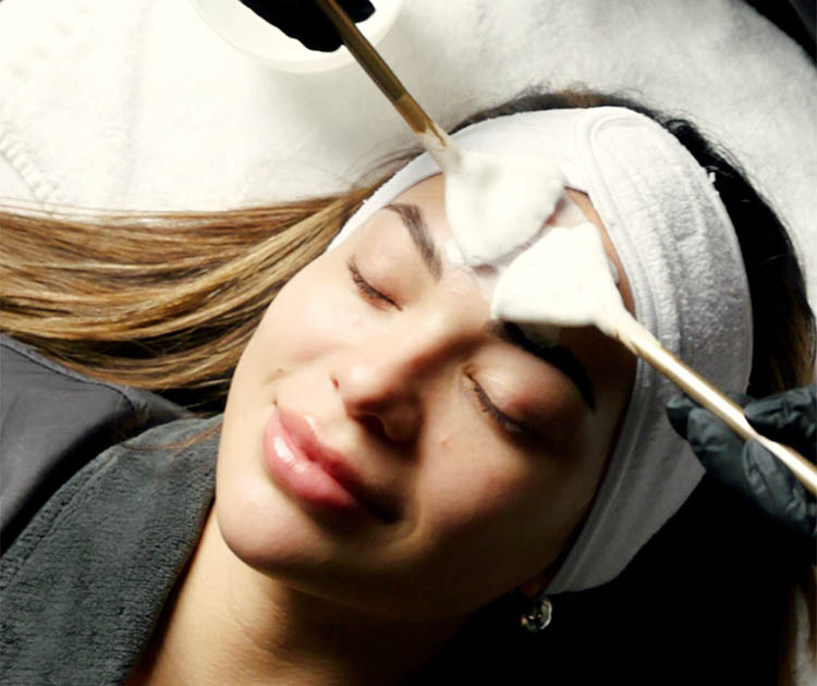 patient receiving chemical facial treatment