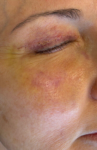 Case # 2 after photo