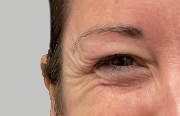 Case # 1 before photo