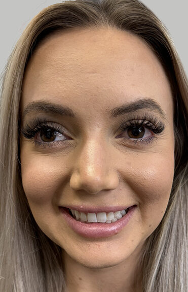 Case # 2 before photo