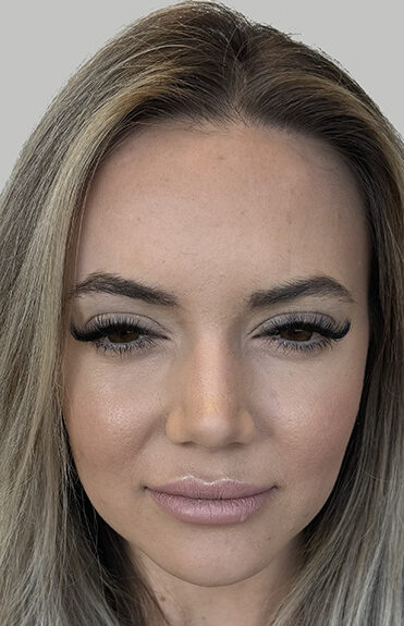 Case # 2 after photo