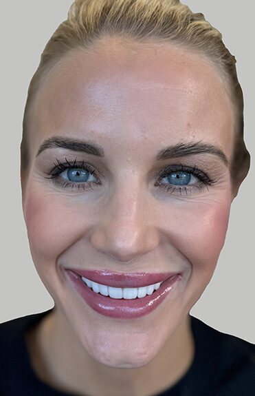 Case # 3 before photo