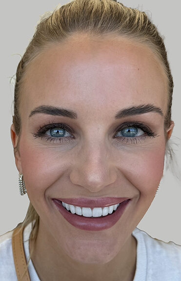 Case # 3 after photo