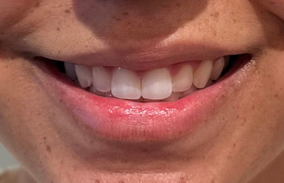 Case # 5 before photo