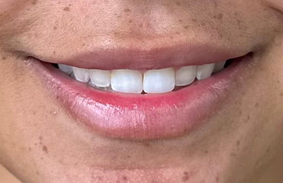 Case # 5 after photo