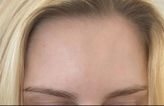 Case # 6 after photo