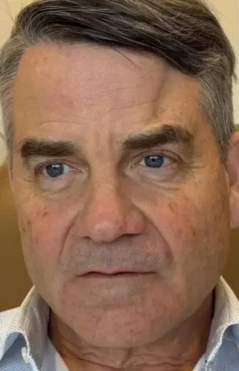 Case # 8 before photo