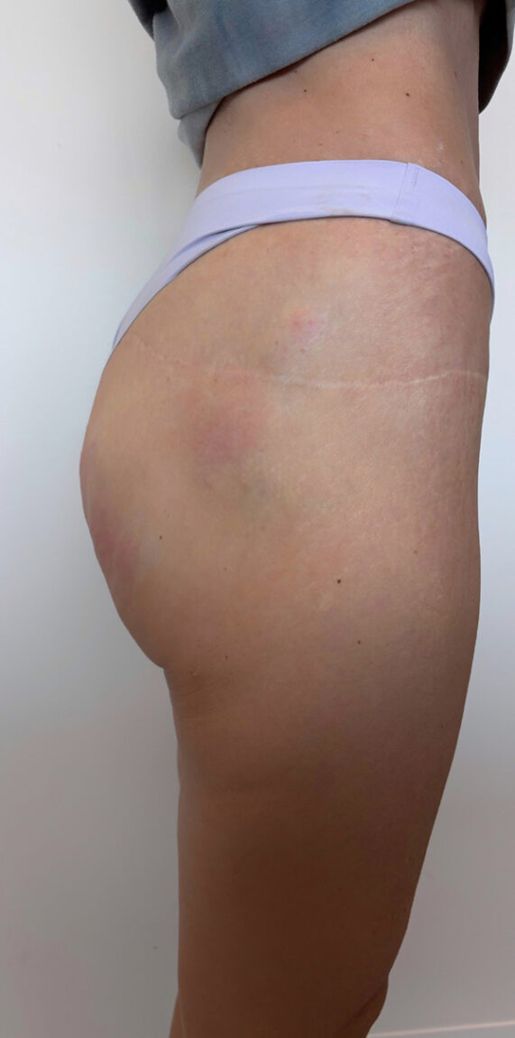 Case # 3 after photo