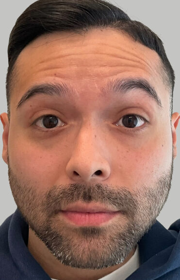 Case # 9 before photo