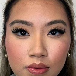 Botox/Dysport Before & After Patient #846