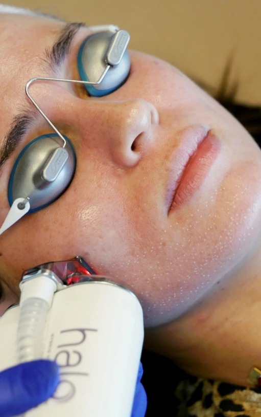 Lasers & Radiofrequency, Houston TX, My Evergreen MedSpa